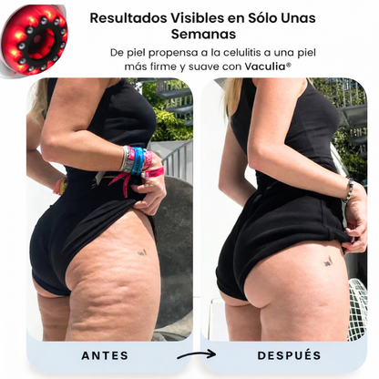 Masajeador Vaculia™